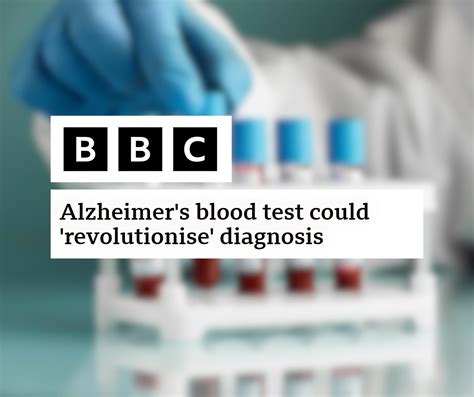 Big news 🚨👇 One simple blood test... - Alzheimer's Society | Facebook