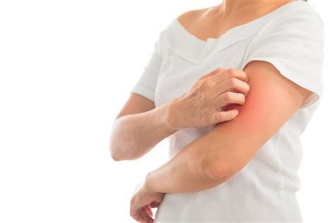 Как выглядят поражения кожи при псориазе? | MedAboutMe