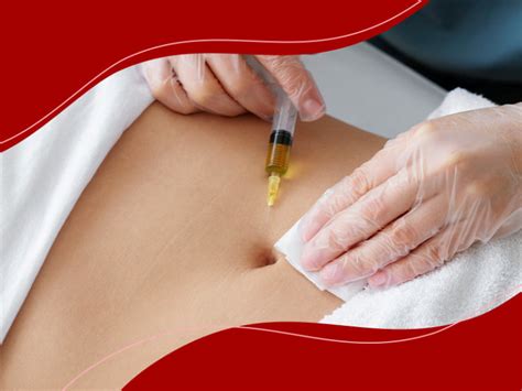 Mesoterapia O Que É - Mesoterapia: O que é, benefícios, riscos e resultados