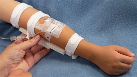 Nursing Iv Complications Phlebitis Infiltration