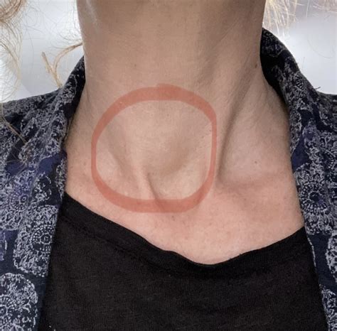 Strange neck/throat sensation | Mumsnet