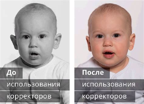 Корректоры для ушей Arilis купить в Краснодаре, цена