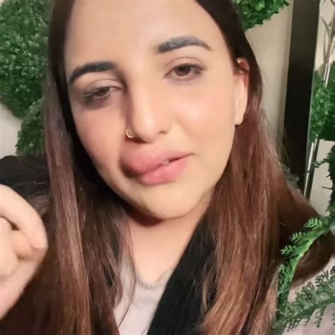 Pakistani TikTok Star Gets Botched Lip Fillers In Viral Video WATCH