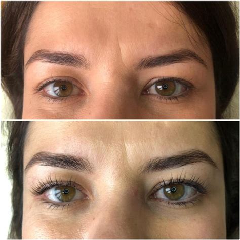 Ботокс для ресниц отзывы фото до и после: Процедура BOTOX LASHES ...