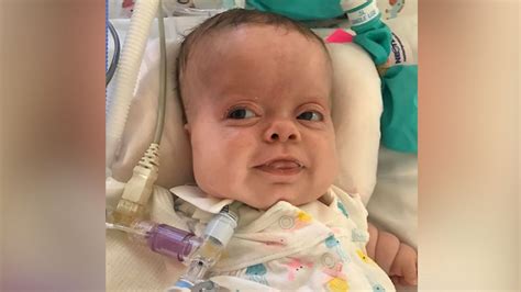 Baby with rare dwarfism goes home after 184 days in hospital - Good ...