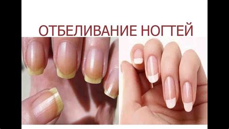 ОТБЕЛИВАНИЕ НОГТЕЙ nail care в домашних условиях - YouTube