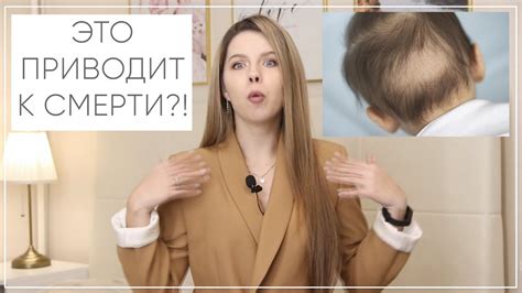 №67 ВЫПАДАЮТ ВОЛОСЫ У РЕБЕНКА ЧТО ДЕЛАТЬ | ЛЫСЫЙ ЗАТЫЛОК - YouTube