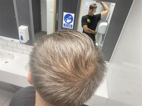 buzz cut for thinning hair 1