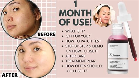 How to use The Ordinary AHA 30% + BHA 2% Peeling Solution 2023
