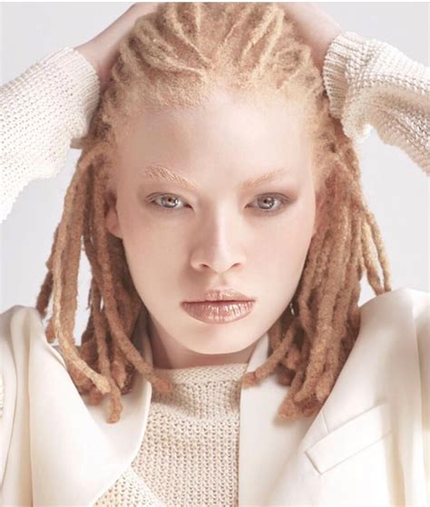 Wow 😲 | Albino model, Albino girl, Dreads girl