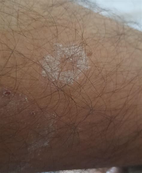 What is this. Just dry skin ? : r/skin