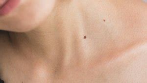 General 1 — Beaches Dermatology