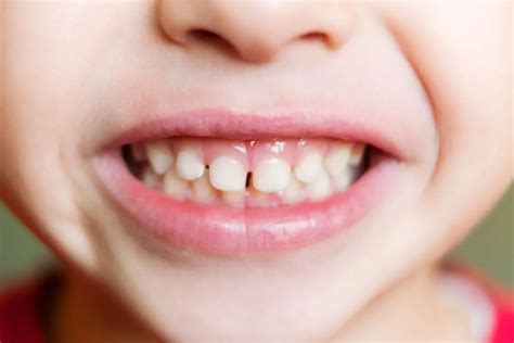 types  teeth   functions fox point dental