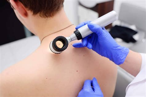 What Are The Types of Skin Cancer and What Screening Tests Are There?
