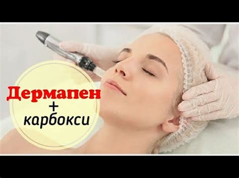 Карбокситерапия и дермапен (микронидлинг). Сочетанные методики ...