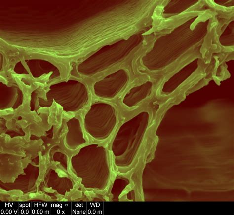 The SPIDERLEGS Conundrum: Electron Microscope Images