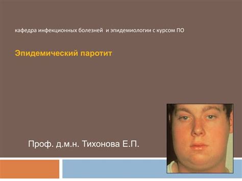 паротит | PPT