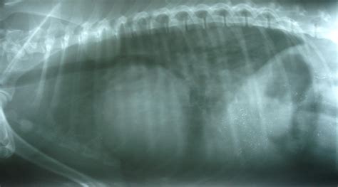 Cardiomegalia