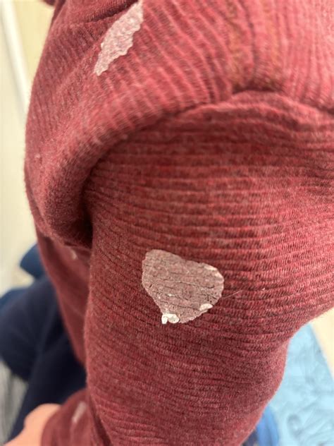 how to get sticker residue off pants 7