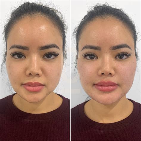 asymmetrical face exercises