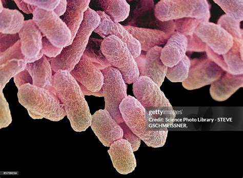 Colored Scanning Electron Micrograph High-Res Stock Photo - Getty Images 