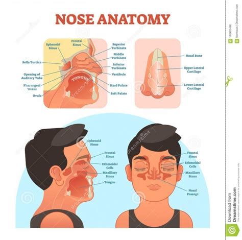 Stuffy Nose Diagram