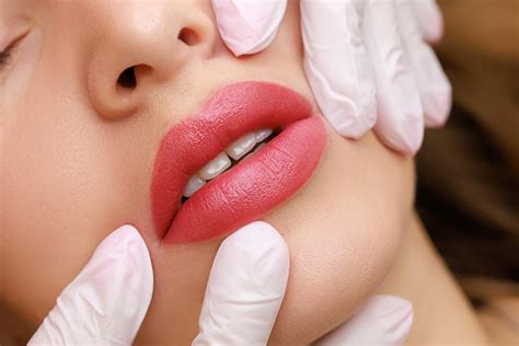 Lip Filler Migration: What is It and Can It Be Prevented? - Park Lane Aesthetics | Medspa Kleinburg