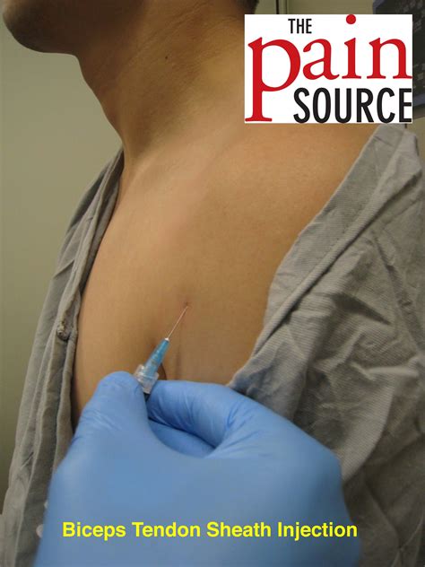 Bicipital Groove Palpation