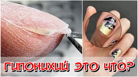 Гипонихий что это? Что такое гипонихий? Стемпинг лаком / Лак для ...