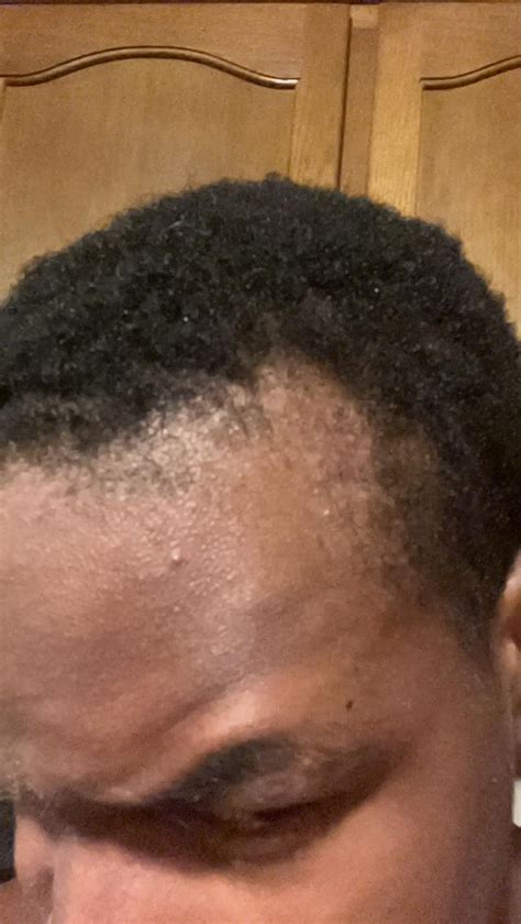 Is this hair growth on the hairline? : r/malehairadvice