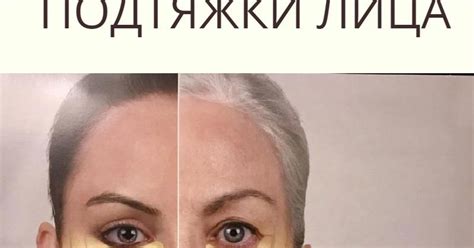 Невозможное возможно! 3 упражнения для безоперационной подтяжки лица ...