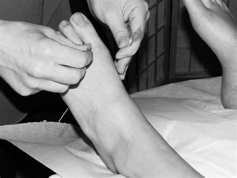 Services | Auburn Acupuncture