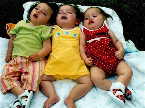 causes of Krabbe's disease - MEDizzy