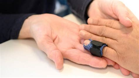 how to know if you broke your finger