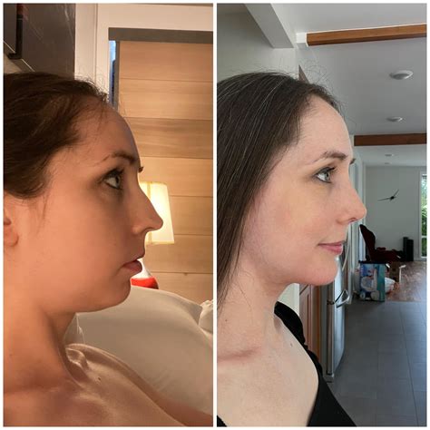 Ambsofficial: Before And After You WON'T Believe
