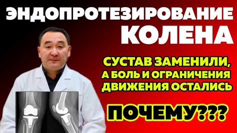 Замена коленного сустава - YouTube