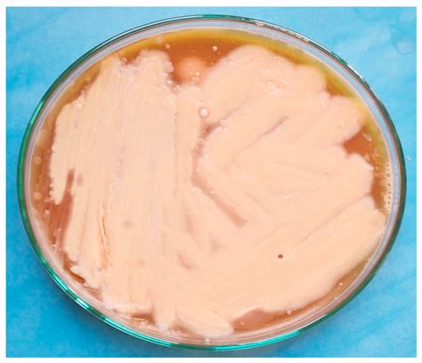 Clostridium Botulinum In Food