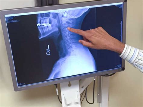 Barium Swallow: What to Expect, Side Effects, and Cost