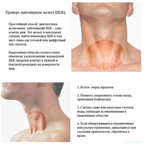 Видимые признаки заболевания щитовидной железы