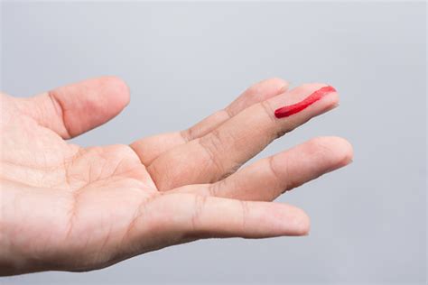 Cortei O Dedo E Não Para De Sangrar - Sangre Sangrante Por La Herida Cortada En El Dedo Dedo Lesionado Con ...