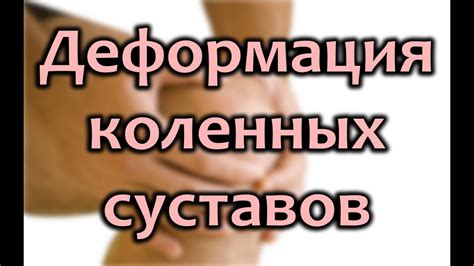 Деформация коленного сустава: причины и лечение - YouTube