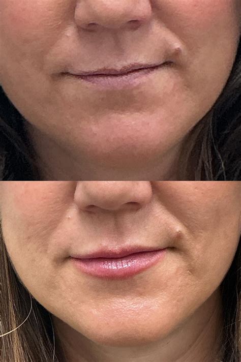 Boone Dermatology Clinic | Boone NC