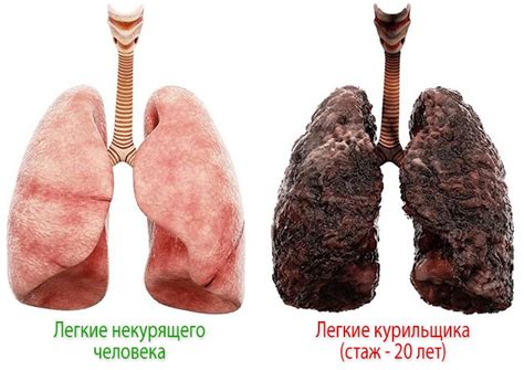 Язык курильщика фото