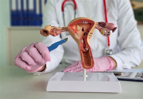 Recovering from Pelvic Organ Prolapse Surgery: An Honest, Unfiltered