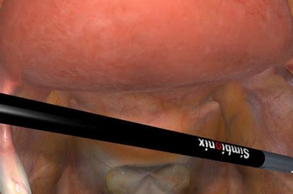 LAP Mentor - Surgical Science