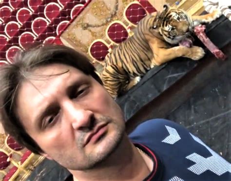 «Теперь у меня есть своя Эйфелева башня»: Запашный показал шрам от ...