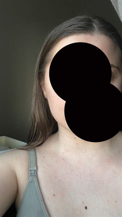 whats  undertone rmakeupaddictioncanada