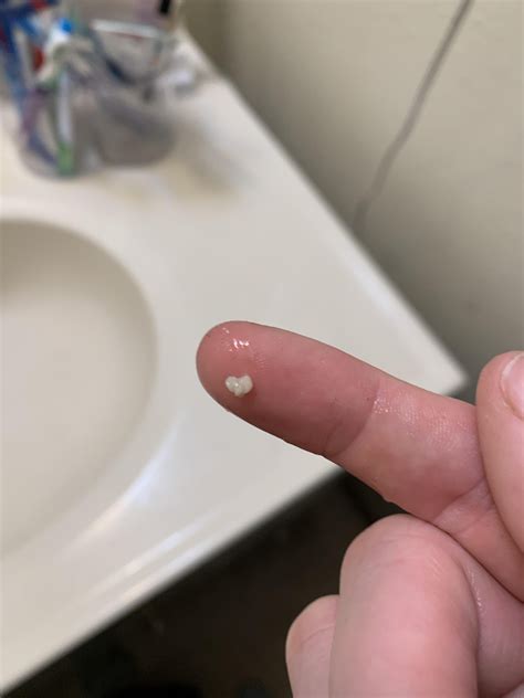 This secret the junkyard denver feature is totally hidden 29