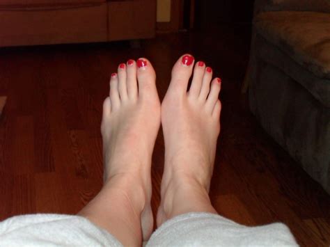Treatment For Hammer Toe Pain - Nerissa Hamburger