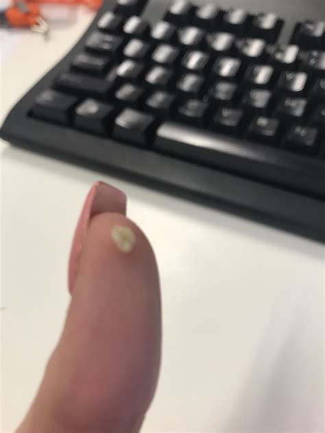 This little guy popped out today : r/popping